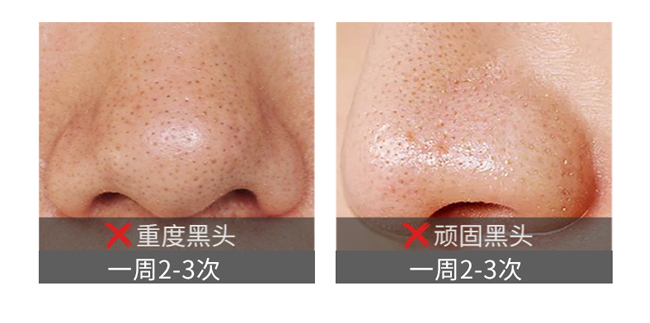 ��ɽ��ȥ���^���N