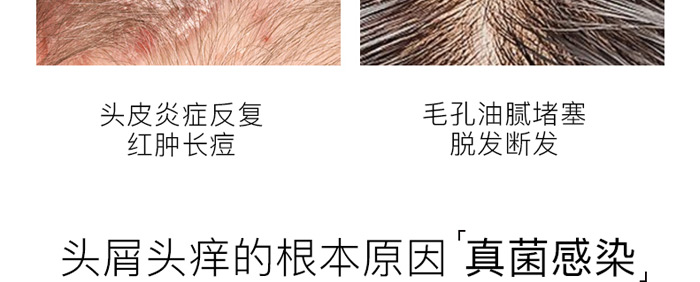 ����ֲ��ȥм����ϴ�l(f��)��