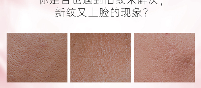 Piccoch�zԭ��Β����AҺ